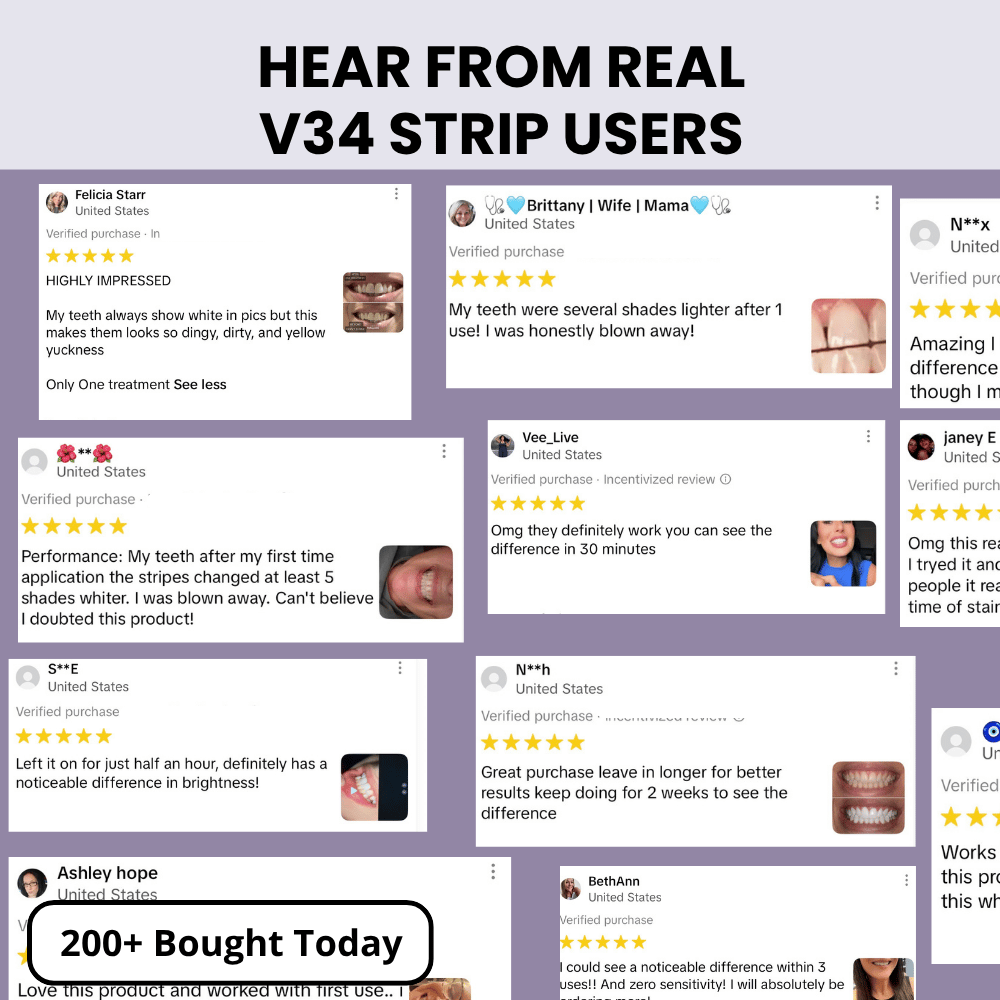 V34 Instant & Gentle Bright™ Strips