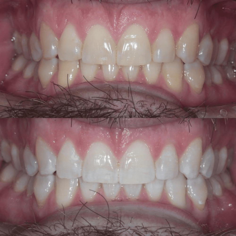 <h2>20,000+ Brighter Smiles</h2>