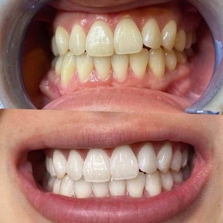 <h2>20,000+ Brighter Smiles</h2>