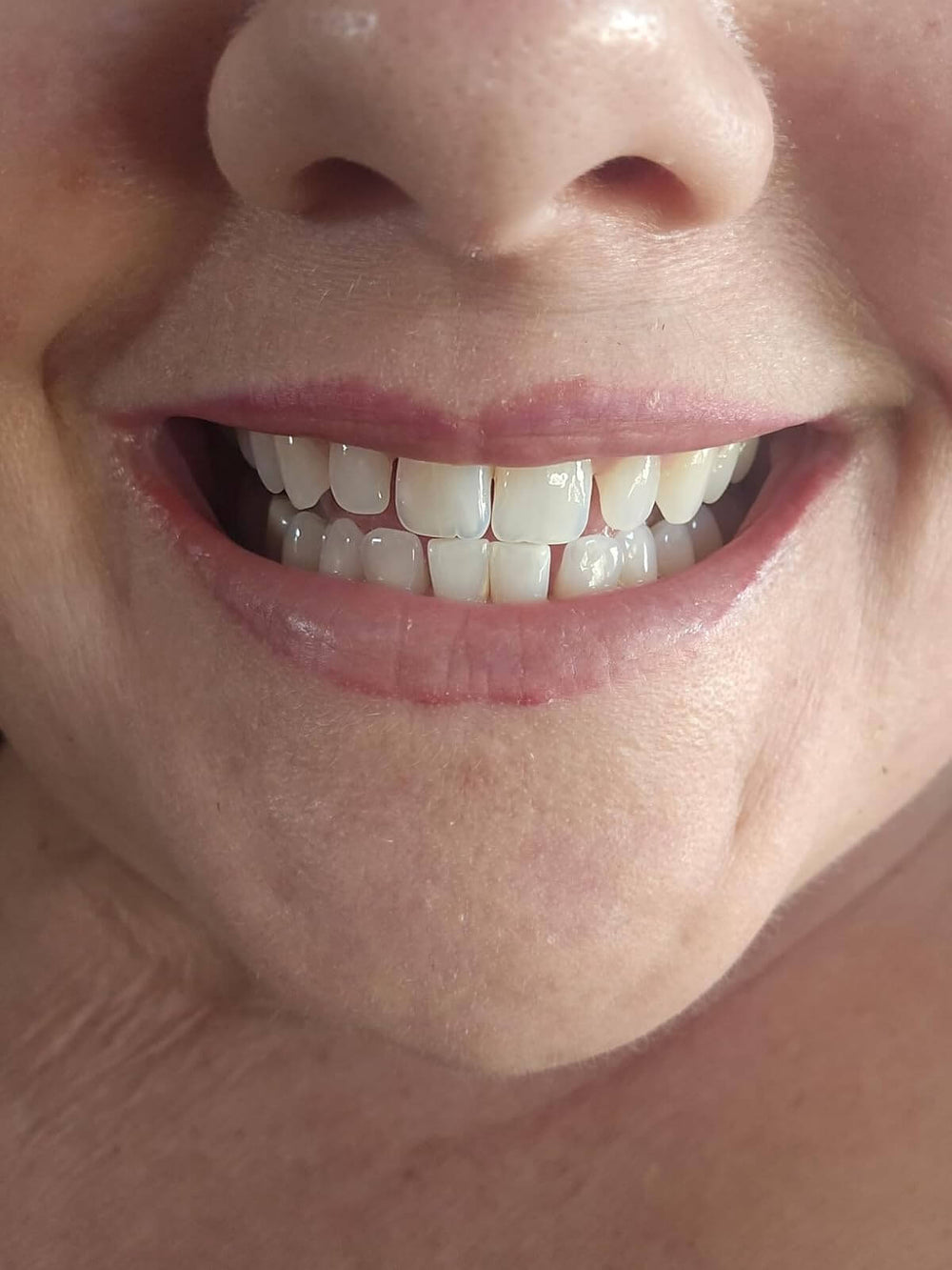 <h2>20,000+ Brighter Smiles</h2>