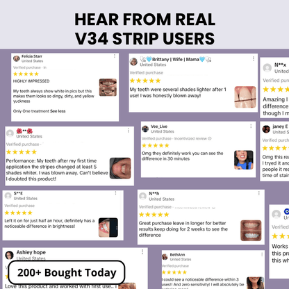V34 Instant & Gentle Bright™ Strips
